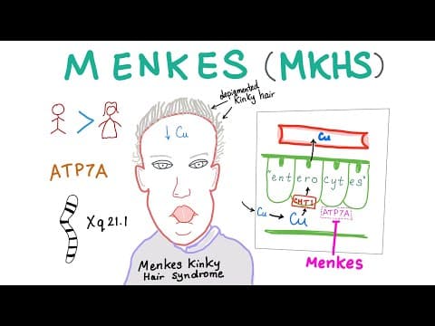 Menkes kinky hair syndrome